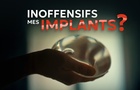 Inoffensifs, mes implants?